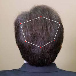 Picture of Revifol results after.